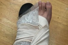 FTISLANDイ・ホンギ、ライブで足を負傷「心配しないで」